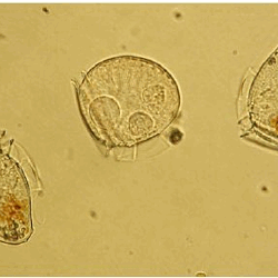 Cellules de Dinophysis sp. observées au microscope optique